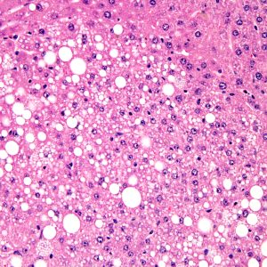 Office Syndrome Deep Tissue