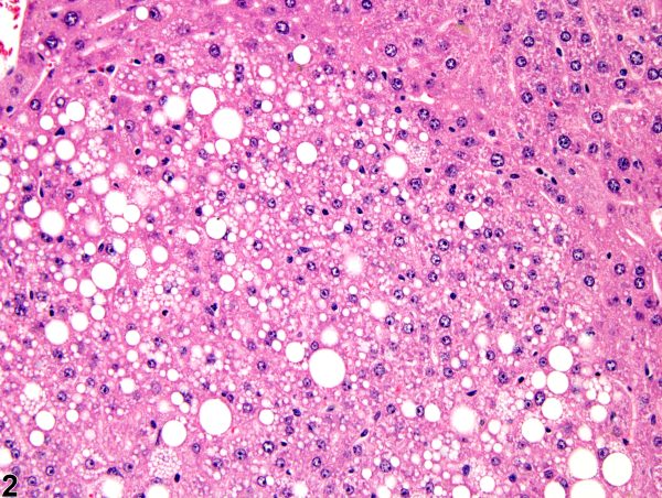 Office Syndrome Deep Tissue