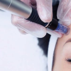 Hydration and Firm Treatment by Nano Needling - 1 session 70 Mins