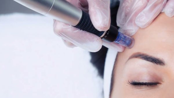Hydration and Firm Treatment by Nano Needling - Bundle of 4 sessions 70 Mins