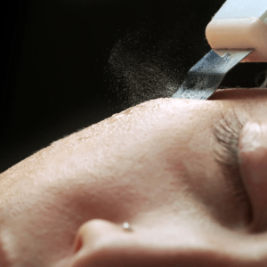 The FlashLift Contour –  Cold Therapy Finish